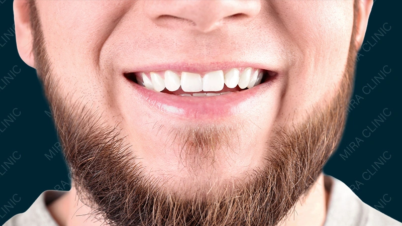 Hollywood smile Skin tone and age influence 